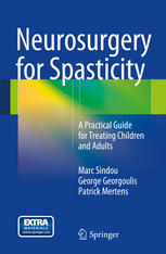 Neurosurgery for Spasticity: A Practical Guide for Treating Children and Adults 2014
