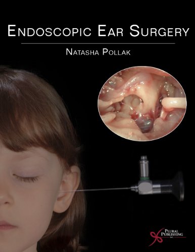 Endoscopic Ear Surgery 2014