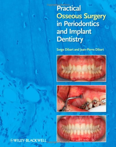 Practical Osseous Surgery in Periodontics and Implant Dentistry 2011