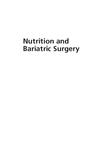 Nutrition and Bariatric Surgery 2014