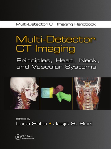 Multi-Detector CT Imaging: Principles, Head, Neck, and Vascular Systems 2013