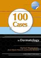 100 Cases in Dermatology 2011