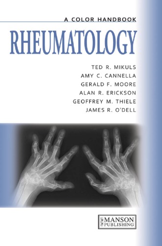 Rheumatology: A Color Handbook 2013