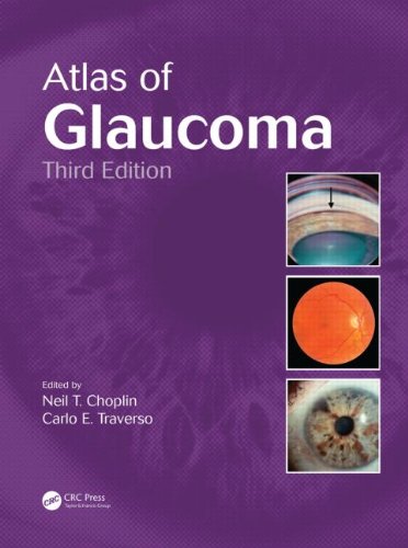 Atlas of Glaucoma, Third Edition 2014