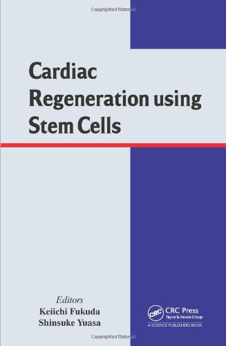 Cardiac Regeneration using Stem Cells 2013