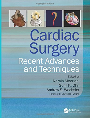 Cardiac Surgery: Recent Advances and Techniques 2013