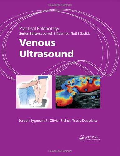 Practical Phlebology: Venous Ultrasound 2013