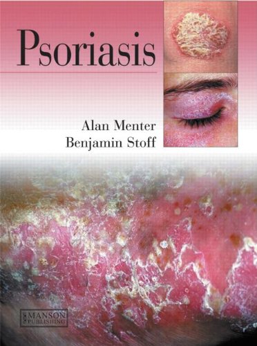 Psoriasis 2010
