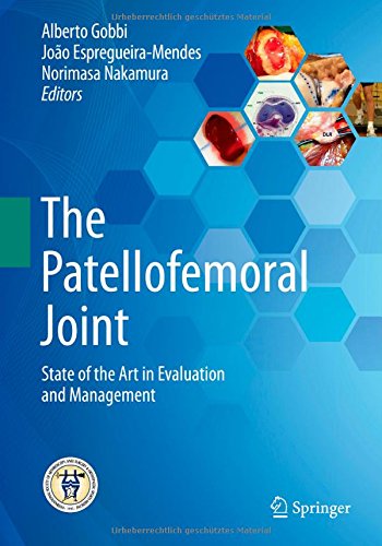 The Patellofemoral Joint: State of the Art in Evaluation and Management 2014