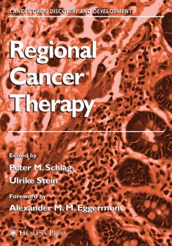 Regional Cancer Therapy 2010