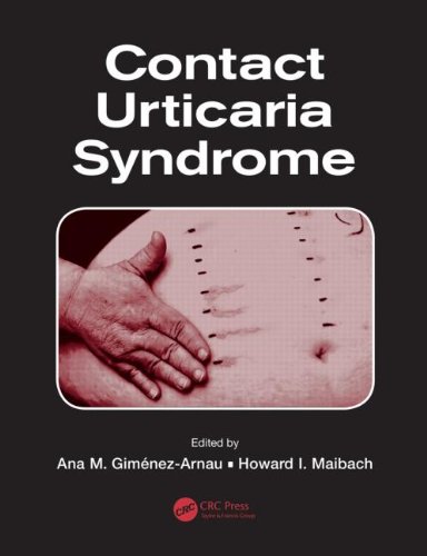 Contact Urticaria Syndrome 2014