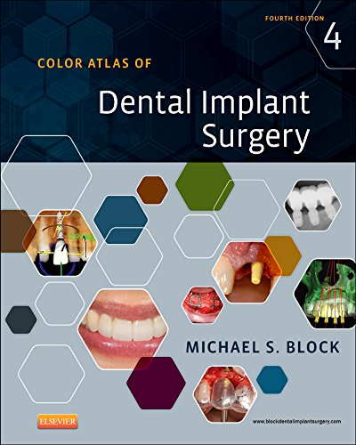 Color Atlas of Dental Implant Surgery 2014