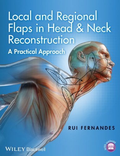 Local and Regional Flaps in Head and Neck Reconstruction: A Practical Approach 2014