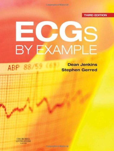 ECGs by Example 2011