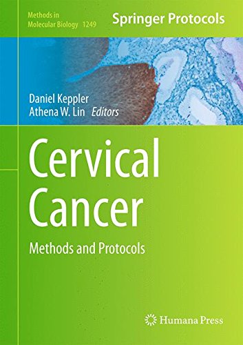 Cervical Cancer: Methods and Protocols 2014