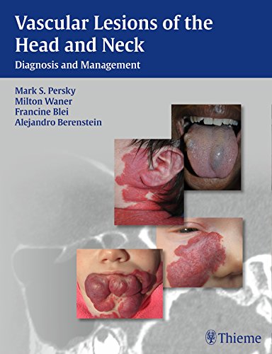 Vascular Lesions of the Head and Neck: Diagnosis and Management 2014