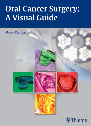 Oral Cancer Surgery: A Visual Guide 2014
