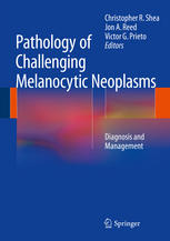 Pathology of Challenging Melanocytic Neoplasms: Diagnosis and Management 2014