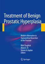 Treatment of Benign Prostatic Hyperplasia: Modern Alternative to Transurethral Resection of the Prostate 2014