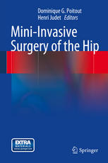 Mini-Invasive Surgery of the Hip 2014