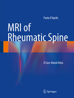 MRI of Rheumatic Spine: A Case-Based Atlas 2014