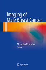 Imaging of Male Breast Cancer 2014