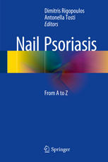 Nail Psoriasis: From A to Z 2014