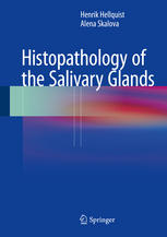 Histopathology of the Salivary Glands 2014