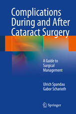 Complications During and After Cataract Surgery: A Guide to Surgical Management 2014