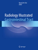 Radiology Illustrated: Gastrointestinal Tract 2014