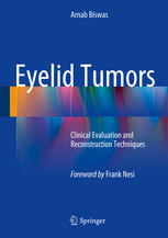 Eyelid Tumors: Clinical Evaluation and Reconstruction Techniques 2014