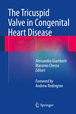 The Tricuspid Valve in Congenital Heart Disease 2014