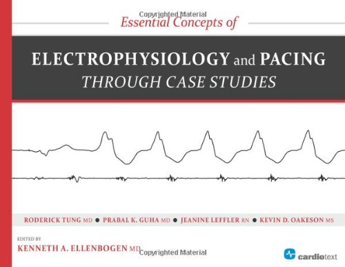 Essential Concepts of Electrophysiology and Pacing Through Case Studies 2014