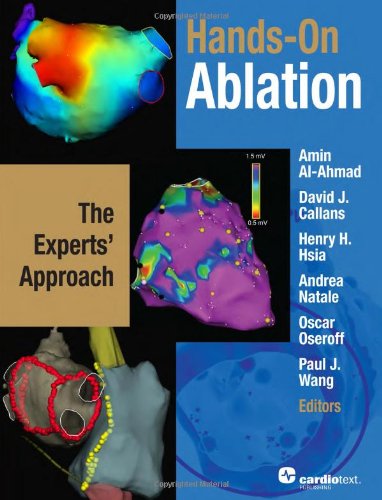 Hands-On Ablation: The Experts' Approach 2011