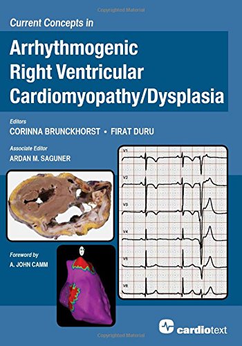 Current Concepts in Arrhythmogenic Right Ventricular Cardiomyopathy / Dysplasia 2014