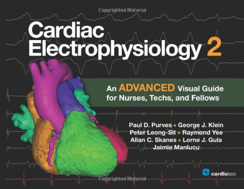 Cardiac Electrophysiology 2: An Advanced Visual Guide for Nurses, Techs, and Fellows 2014