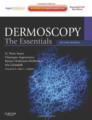 Dermoscopy: The Essentials 2011