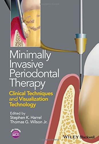 Minimally Invasive Periodontal Therapy: Clinical Techniques and Visualization Technology 2015