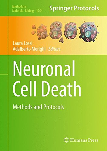 Neuronal Cell Death: Methods and Protocols 2014