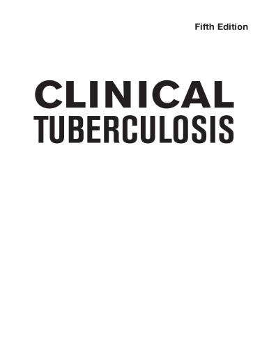 Clinical Tuberculosis 2014