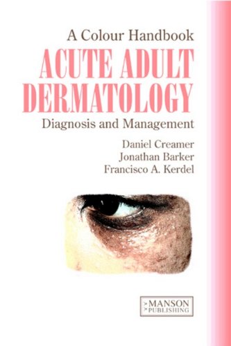 Acute Adult Dermatology: Diagnosis and Management: A Colour Handbook 2011