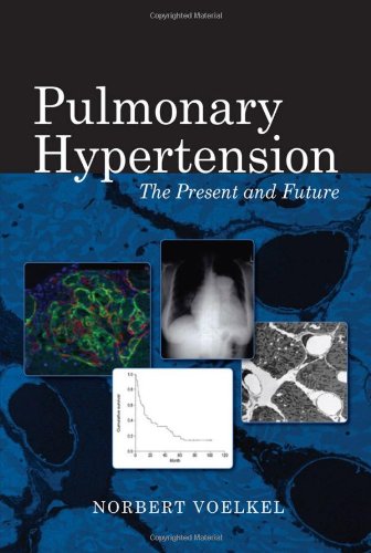 Pulmonary Hypertension: The Present and Future 2011