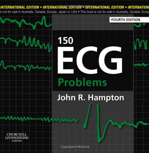 150 ECG Problems 2013