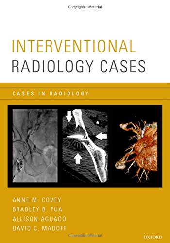Interventional Radiology Cases 2015