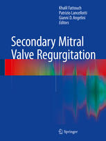 Secondary Mitral Valve Regurgitation 2014