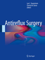 Antireflux Surgery 2014