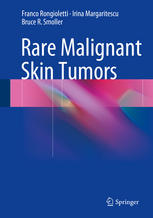 Rare Malignant Skin Tumors 2014