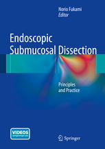 Endoscopic Submucosal Dissection: Principles and Practice 2014