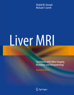 Liver MRI: Correlation with Other Imaging Modalities and Histopathology 2014