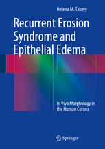 Recurrent Erosion Syndrome and Epithelial Edema: In Vivo Morphology in the Human Cornea 2014